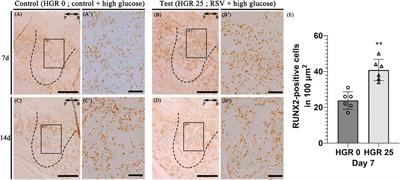 Resveratrol facilitates bone formation in high-glucose conditions